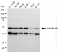 KD-Validated Anti-Actin like 6A Rabbit Monoclonal Antibody